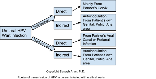 urethral wart